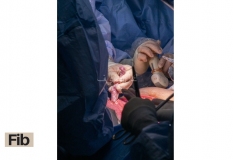 Fetal-surgery-6_800x550